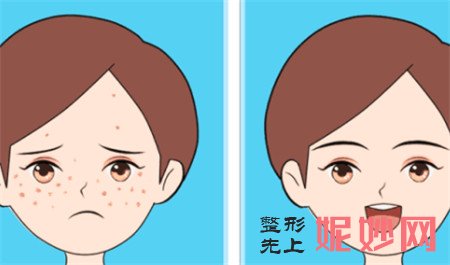 激光祛斑是什么？吉林大学中日联谊医院整形科做激光祛斑有什么优势？
