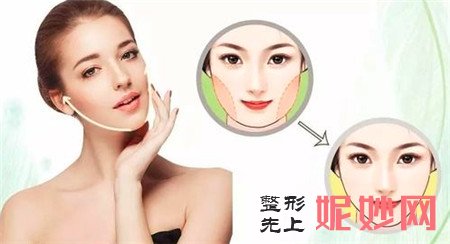 面部吸脂有什么好处？价格是多少？多久才能恢复？