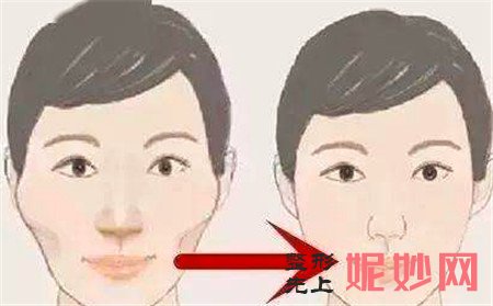 颧骨宽做磨颧骨整形有用吗？北京华韩整形做磨颧骨手术怎么样？