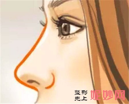 上海九院整形科戴传昌做耳软骨垫鼻尖的效果怎么样？亲做案例效果显著！