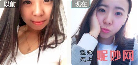 广州紫馨医疗美容医院于晓强医生,简介,擅长项目,出诊时间及案例展示
