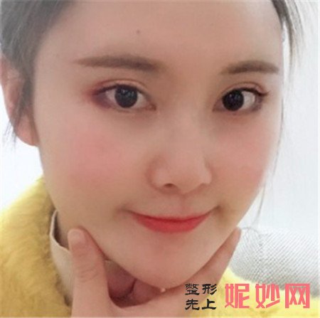 北京八大处的张智勇医生做正颌手术怎么样？真人案例分享