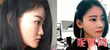 尤建军做鼻子怎么样？