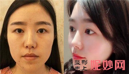 八大处张智勇正颌手术怎么样？