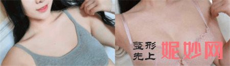 穆大力隆胸怎么样？