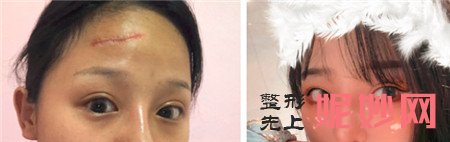 八大处范金财祛疤效果怎么样？
