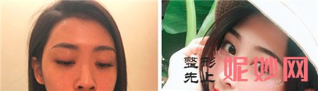 八大处隆鼻哪个医生好？