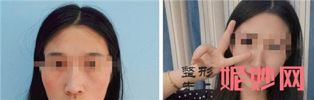 八大处隆鼻哪个医生好？