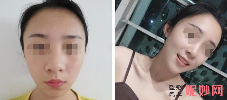 上海做鼻子权威的医院医生盘点，案例分享