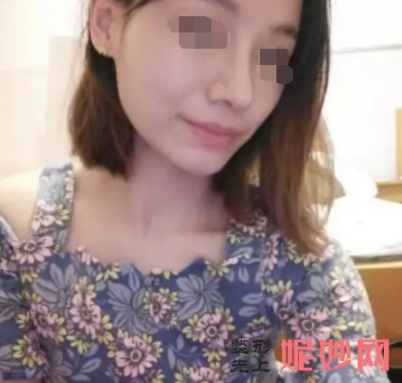 上海华美哪个医生做鼻子好？案例+价格