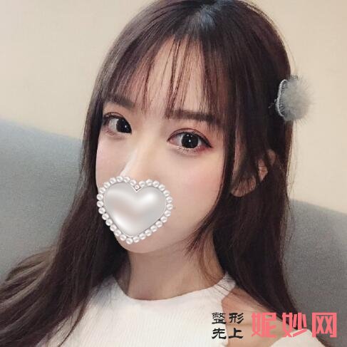 找天津华中医美整形医院做双眼皮手术，解决“无神”双眼！