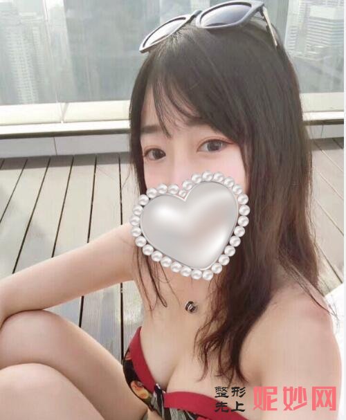 广州安丽维整形割双眼皮怎么样？双眼皮效果图对比！