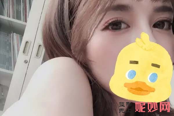 找广州安丽维乔锋丽做双眼皮手术，让小眼睛变成美丽的大眼睛！