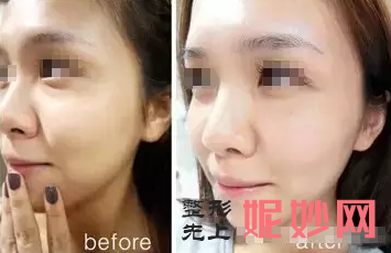 张辉