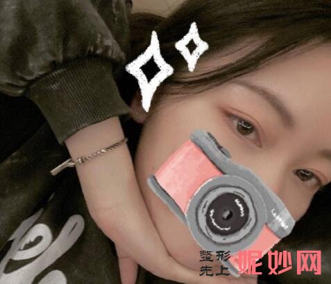 北京春语医疗做祛眼袋案例分享，70天美眼记录来喽！