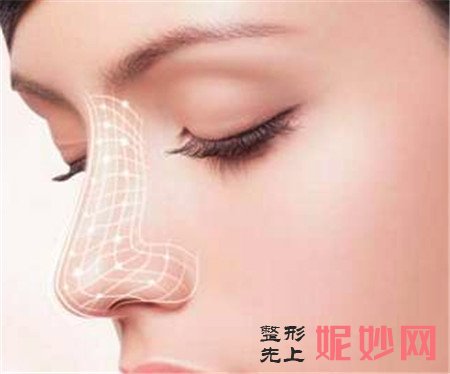 打造精致鼻尖！杭州时光整形胡斌在线为你解答鼻尖移植软骨术的方法！