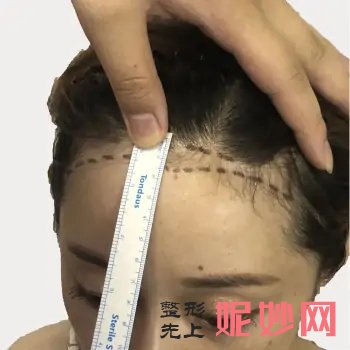 宋忠伟