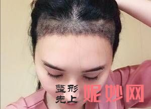 宋忠伟