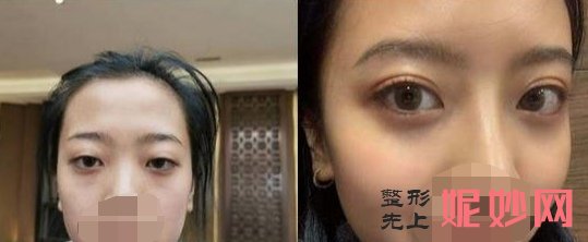 付俊俐