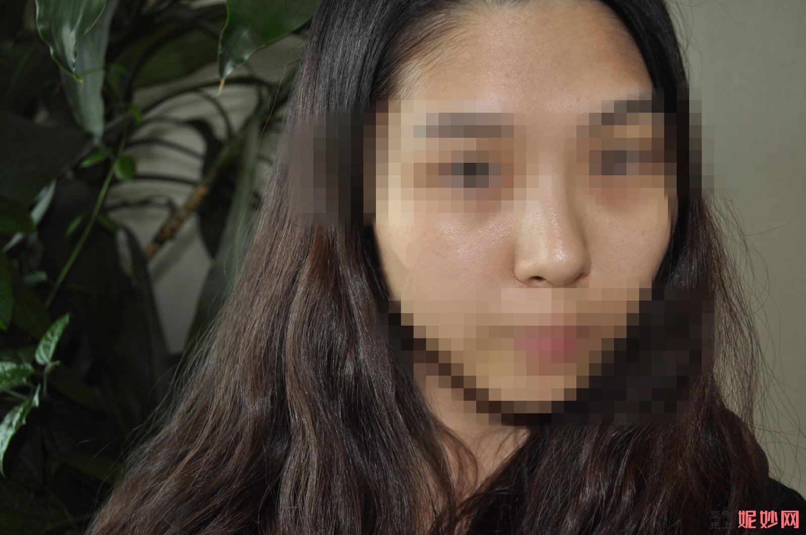 高顺福做鼻子怎么样？真实测评来喽，快来看看真实效果！