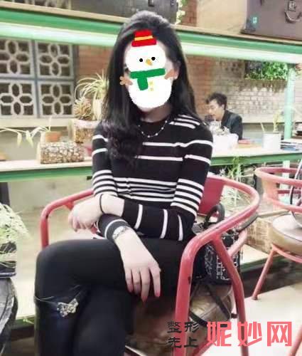 郑州熙禾整形医院怎么样?真人吸脂减肥效果反馈来喽~