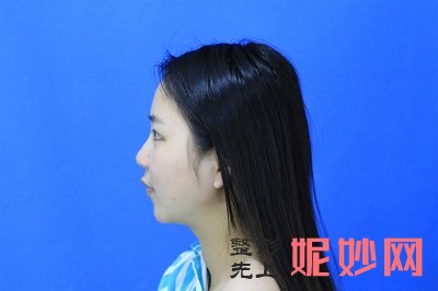 杭州盛美嘉合整形医院怎么样？附鼻综合案例|价格