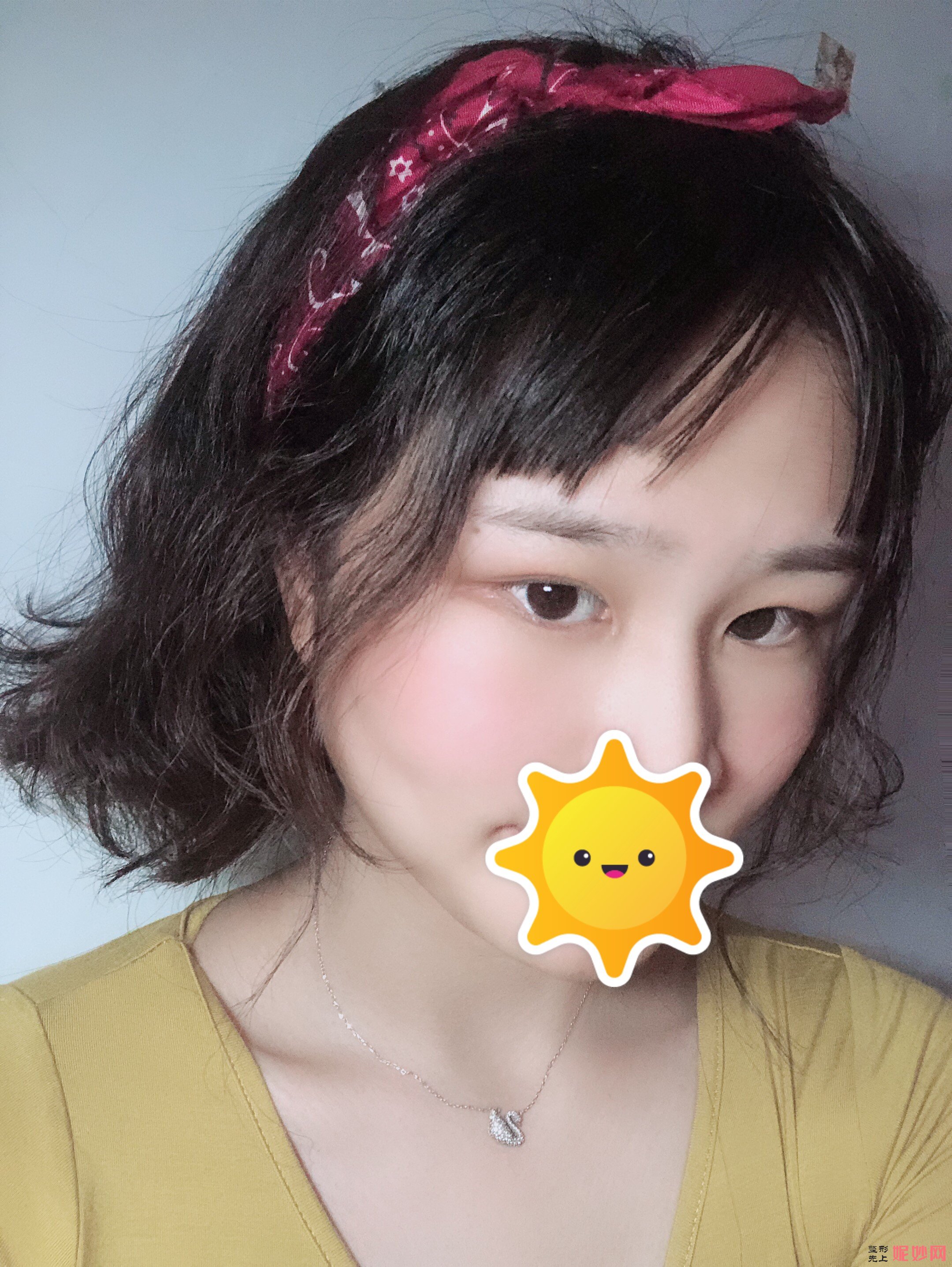 唐美人医疗整形美容医院怎么样？医生介绍+面部除皱案例分享