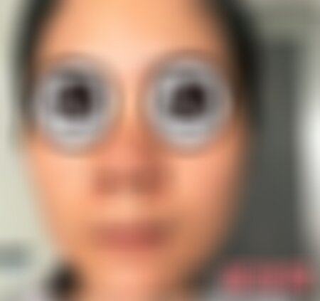 重庆当代整形医院祛斑怎么样？
