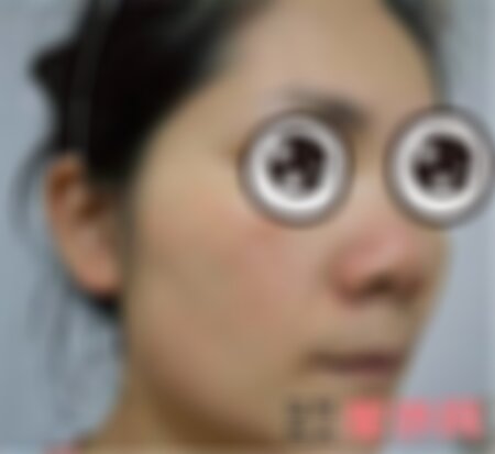 重庆当代整形医院祛斑怎么样？