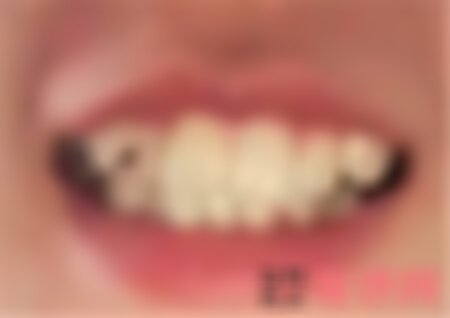 重庆当代整形医院矫正牙齿怎么样？