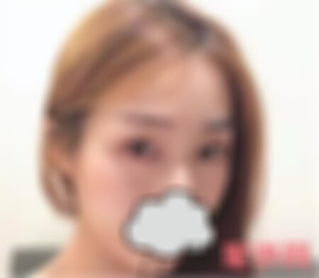 重庆当代整形医院做眼袋手术怎么样？