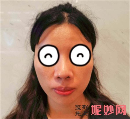 牙祖蒙怎么样？