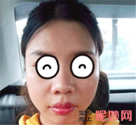 牙祖蒙怎么样？