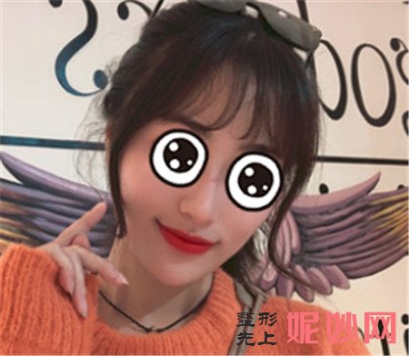王旭明医生做的鼻子怎么样？