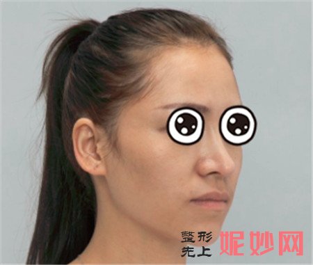 王旭明做鼻修复好吗？