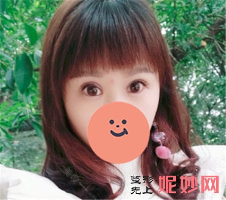 重庆当代王旭明眼睛做的怎么样？