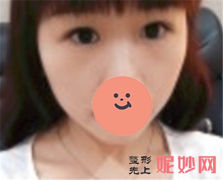 重庆当代王旭明眼睛做的怎么样？