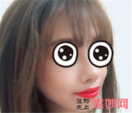 当代黄鲜做鼻子好吗？