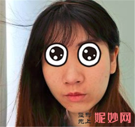 谢锦清做鼻子怎么样？