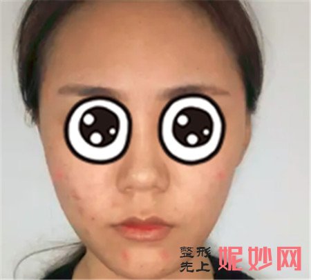 当代张文红怎么样？
