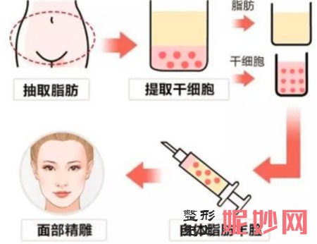 做自体脂肪面部填充哪里好？重庆艺星整形，帮你重回年轻容貌！