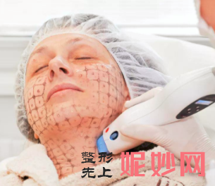 重庆热玛吉除皱哪个医院好？重庆美莱做热玛吉除皱，让肌肤年轻10岁
