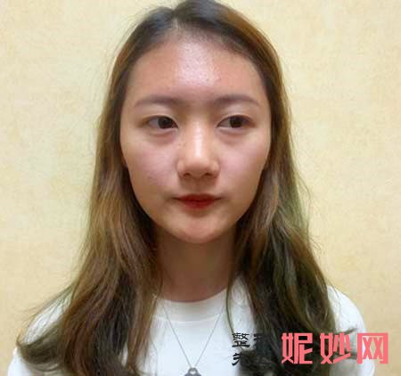 熊宜文鼻子做的好吗？