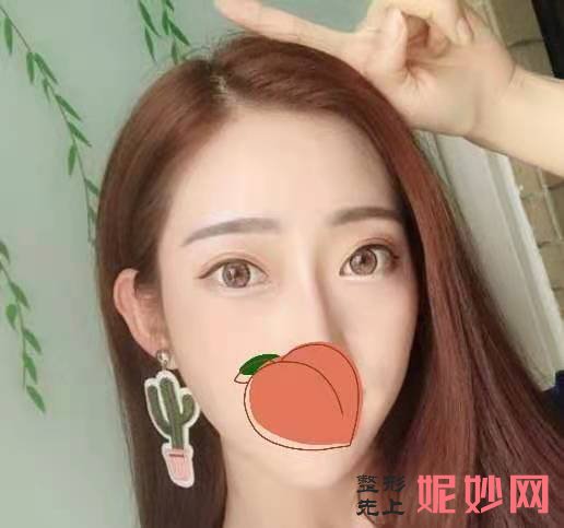 北京丽都医疗美容医院杨斌注射瘦脸怎么样？手术专业，效果好！