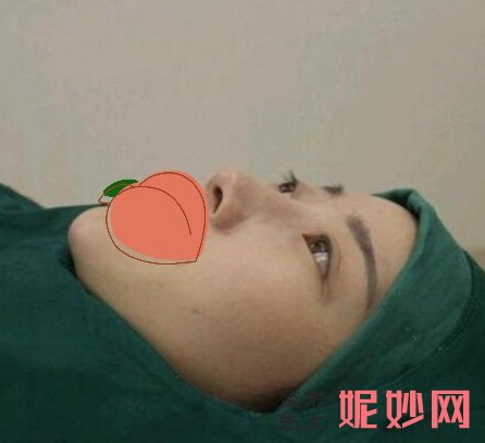 北京丽都医疗美容医院杨斌注射瘦脸怎么样？手术专业，效果好！