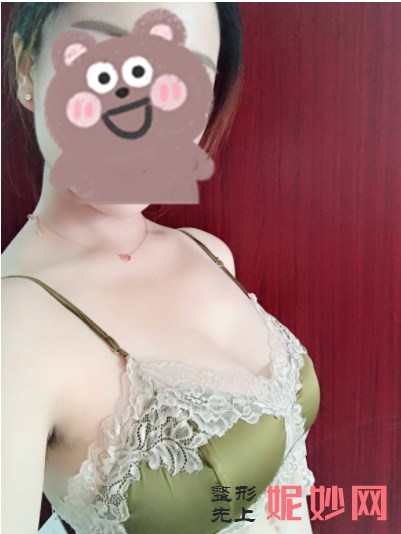 栾杰隆胸怎么样？