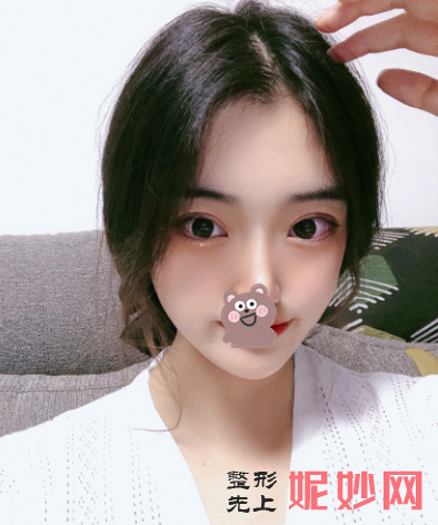 付小卒做双眼皮怎么样？