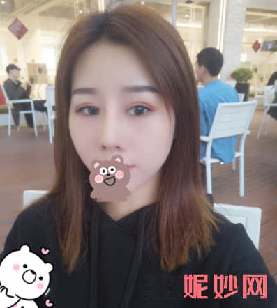 吴玉家做鼻综合怎么样？