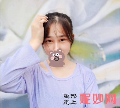 吴玉家双眼皮修复做的好么？