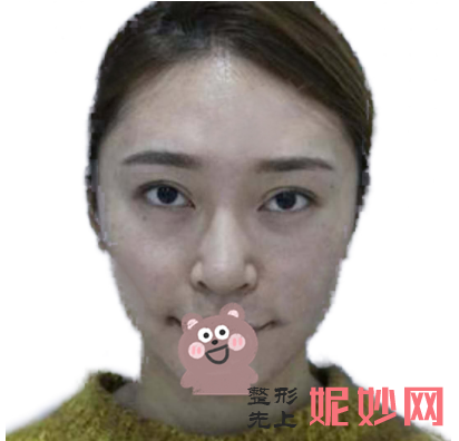 吴玉家做鼻子怎么样？